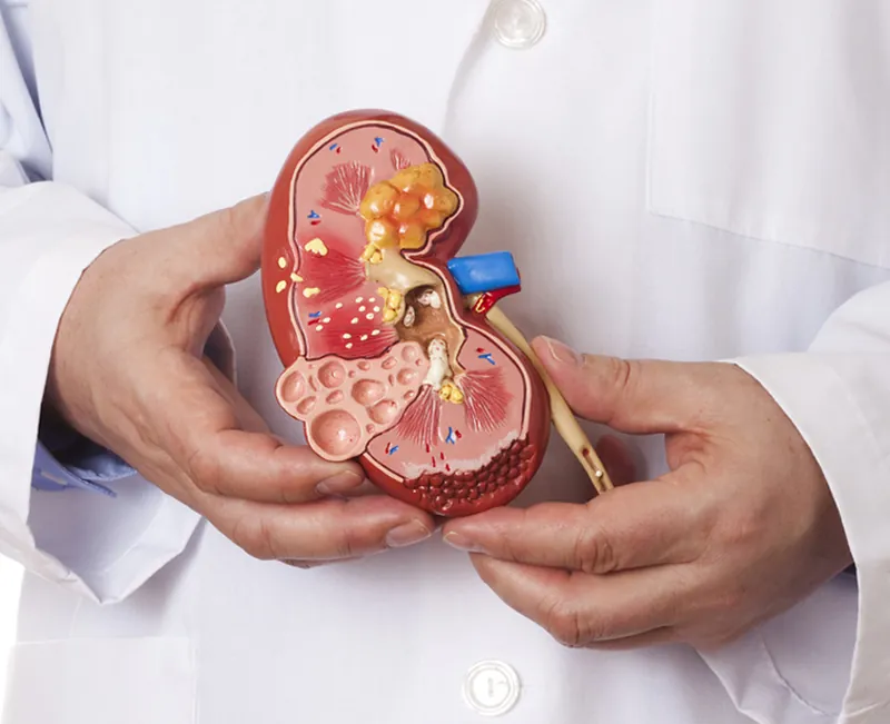 Kidney transplant care