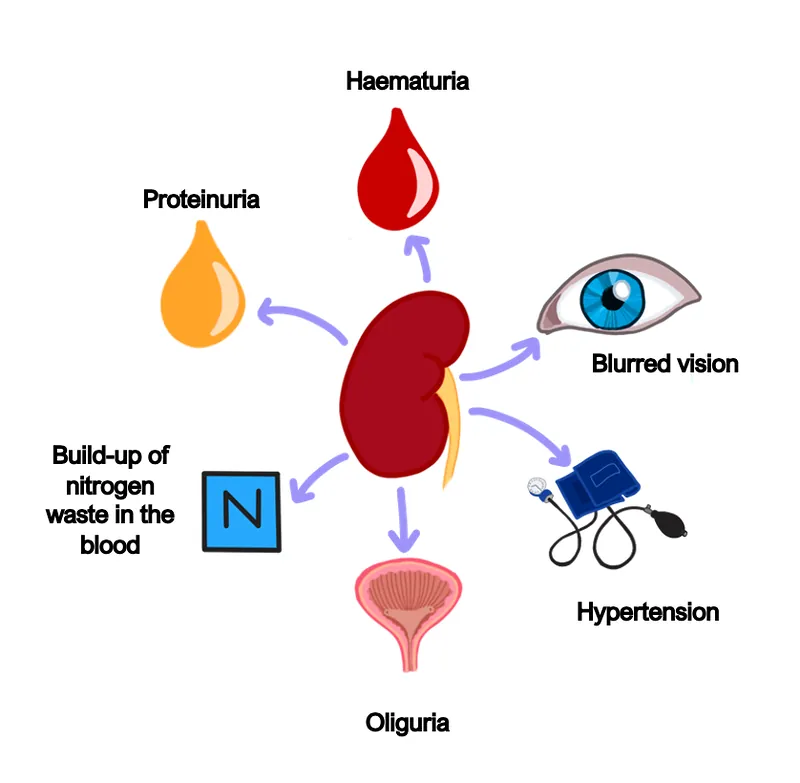 Nephritic syndrome management